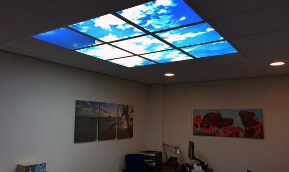 Medicina verlichte plafondplaten (wolken)